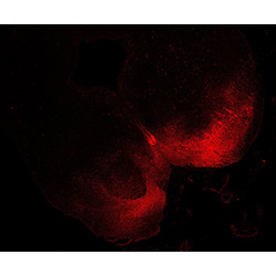 11PCW human midbrain